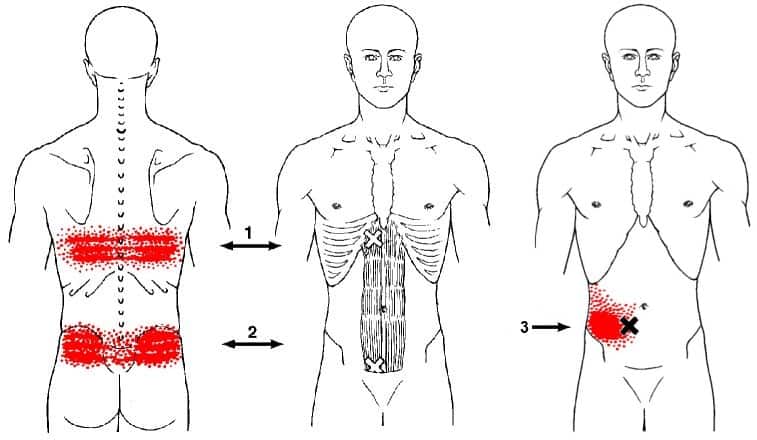 rectus abdominis trigger points