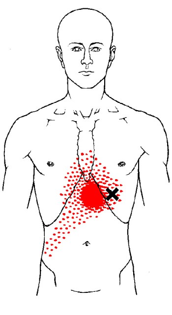 The Definitive Guide To External Oblique Anatomy Exercises Rehab