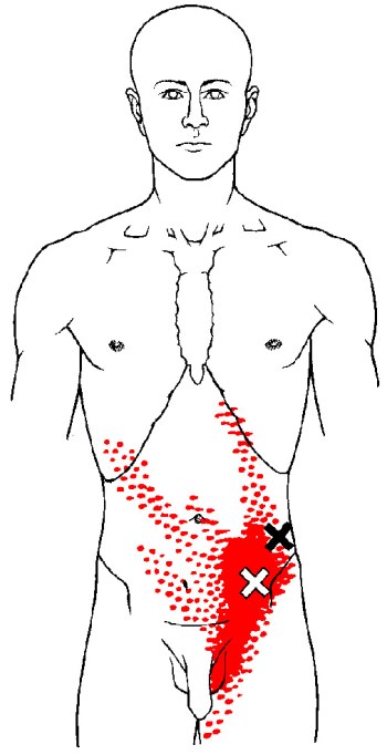 internal-oblique-trp