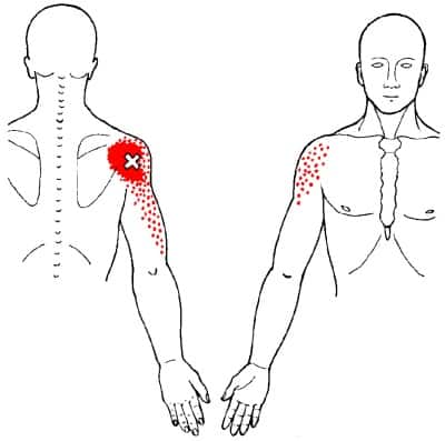 posterior deltoid trigger point