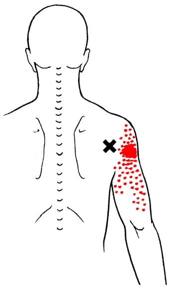 teres minor trigger point